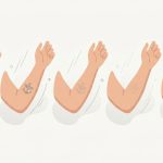 Illustration of a single tattoo fading from dark to nearly gone across a row of stages, representing multiple laser removal sessions