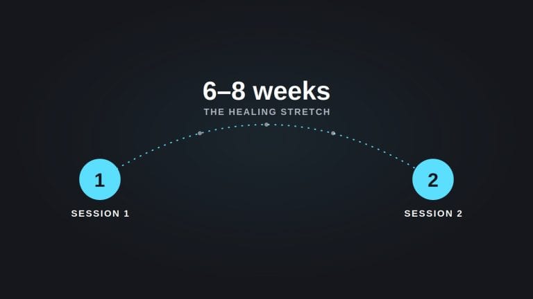 An illustration of two tattoo removal sessions connected by a dotted arc labeled "6 to 8 weeks, the healing stretch," showing the wait between appointments.