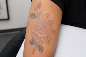 A tattoo partially faded by laser in preparation for a cover-up, showing lightened ink ready for a new design.